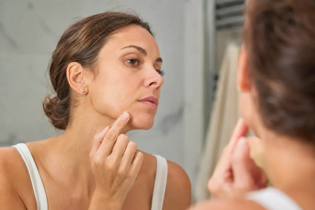 10 Skin Issues That May Reveal Hidden Problems 3 Woman applying spot treatment to jawline acne in the mirror